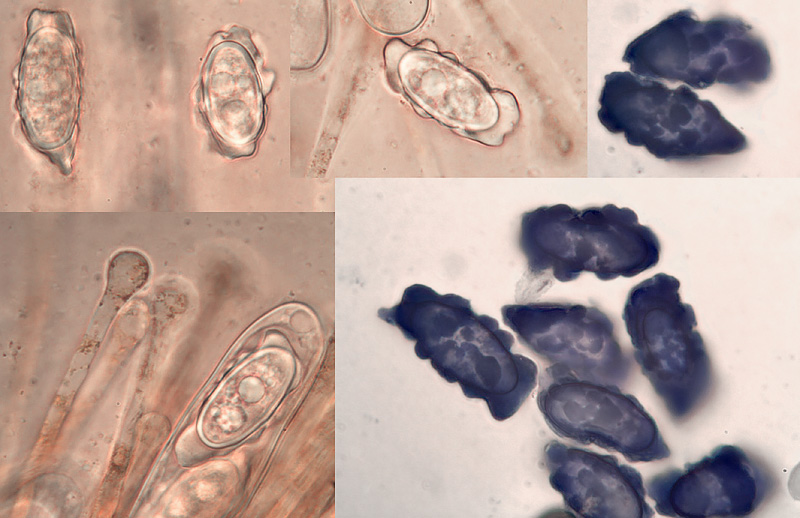 Melastiza contorta micro